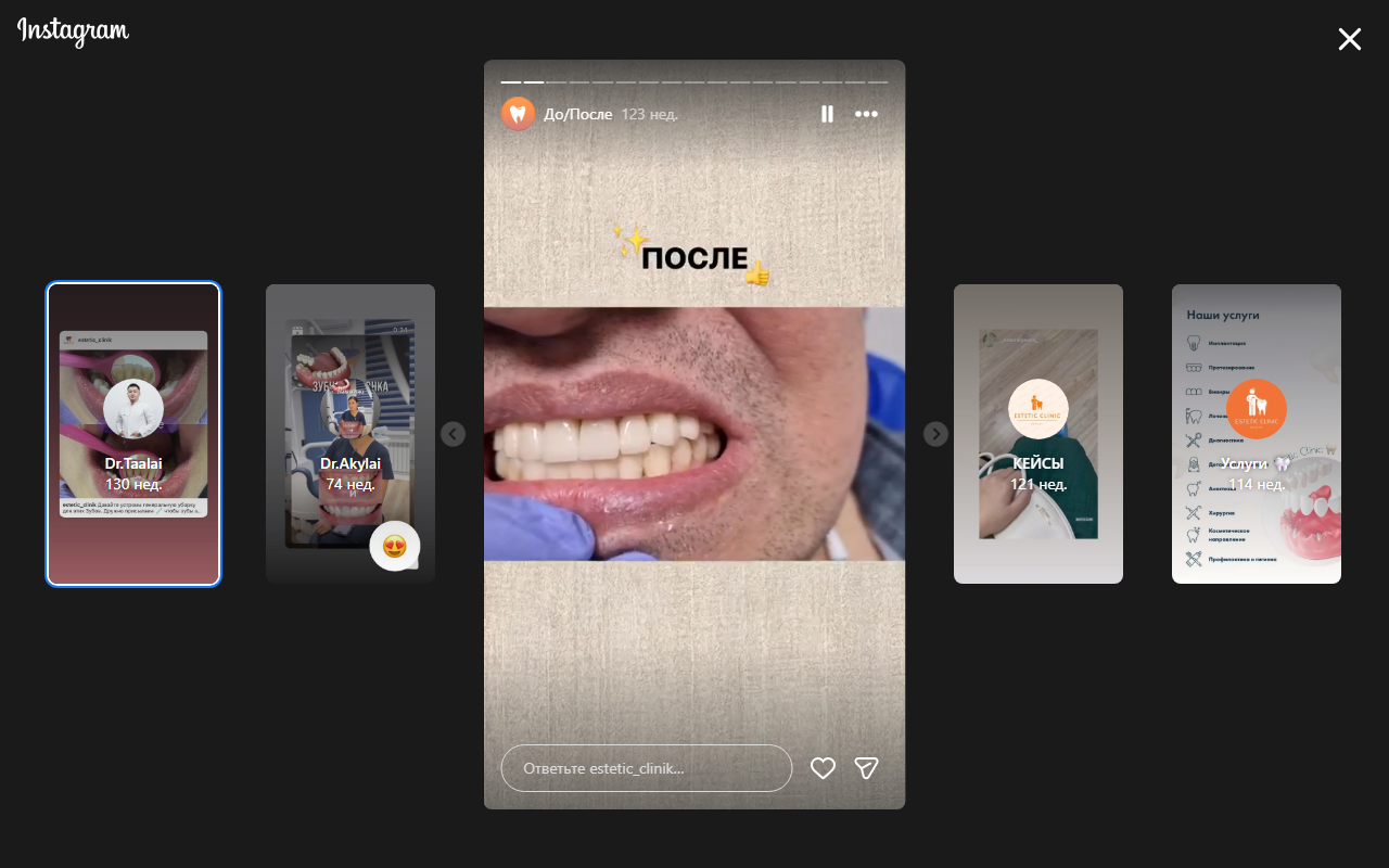 Красивая улыбка после лечения