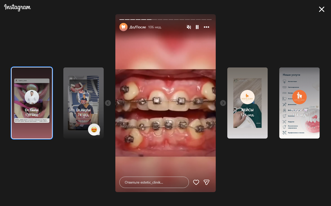 Ортодонтическое лечение