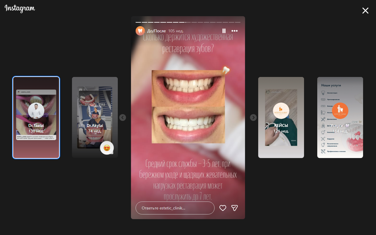 Результат лечения зубов