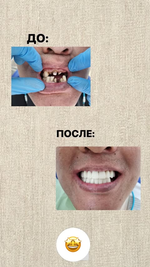 Результат работы -- до и после лечения