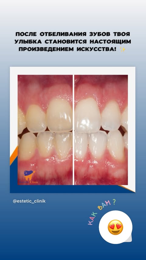 До отбеливания