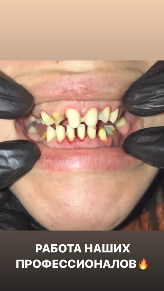 Бесплатная консультация