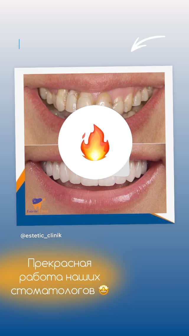 Результат лечения