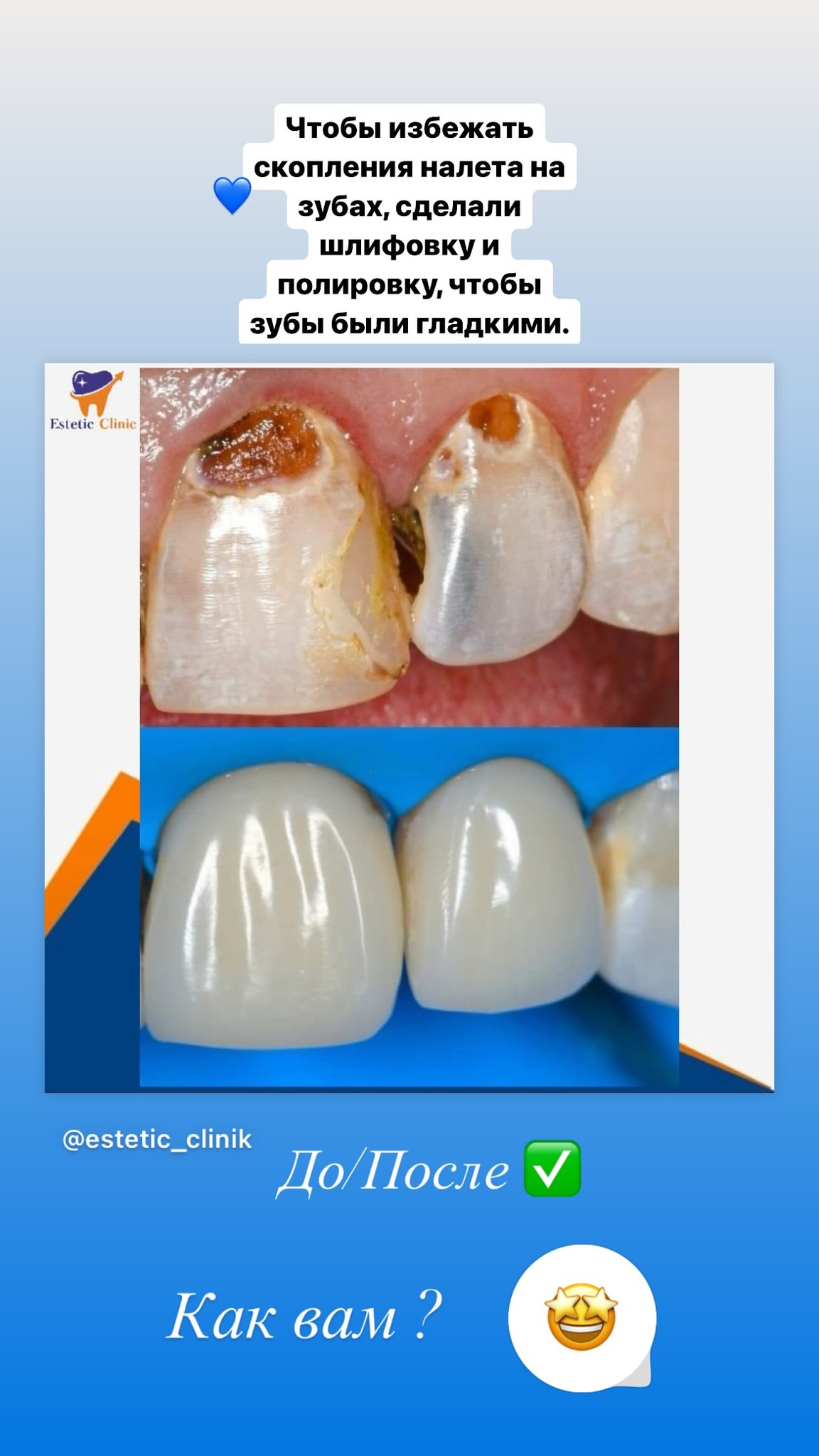 До/После — лечение