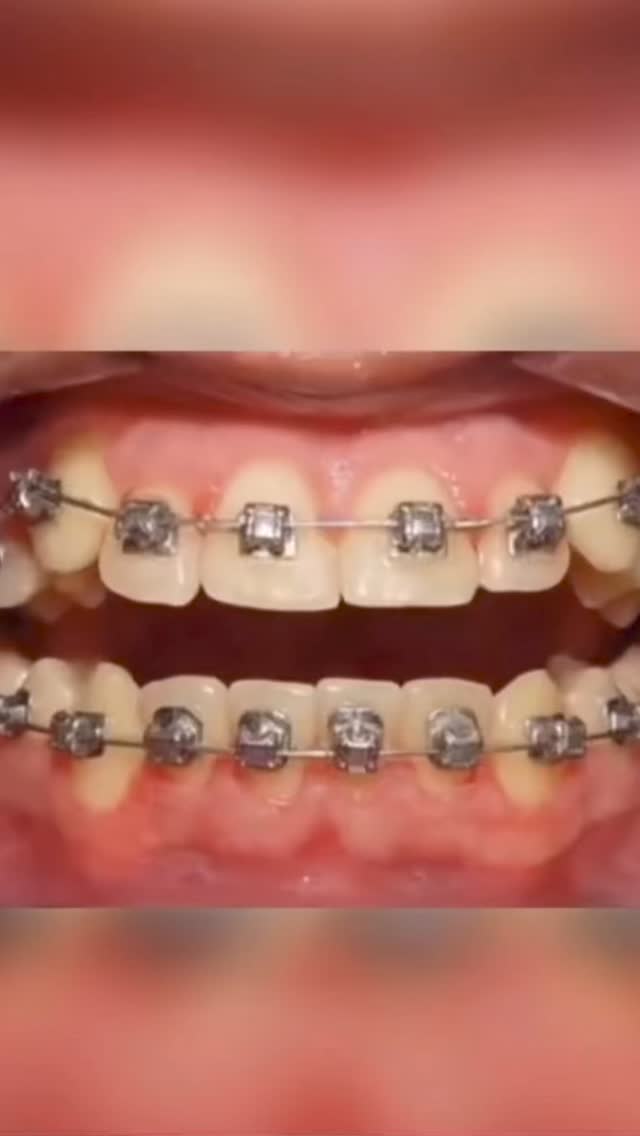 До/После — результат