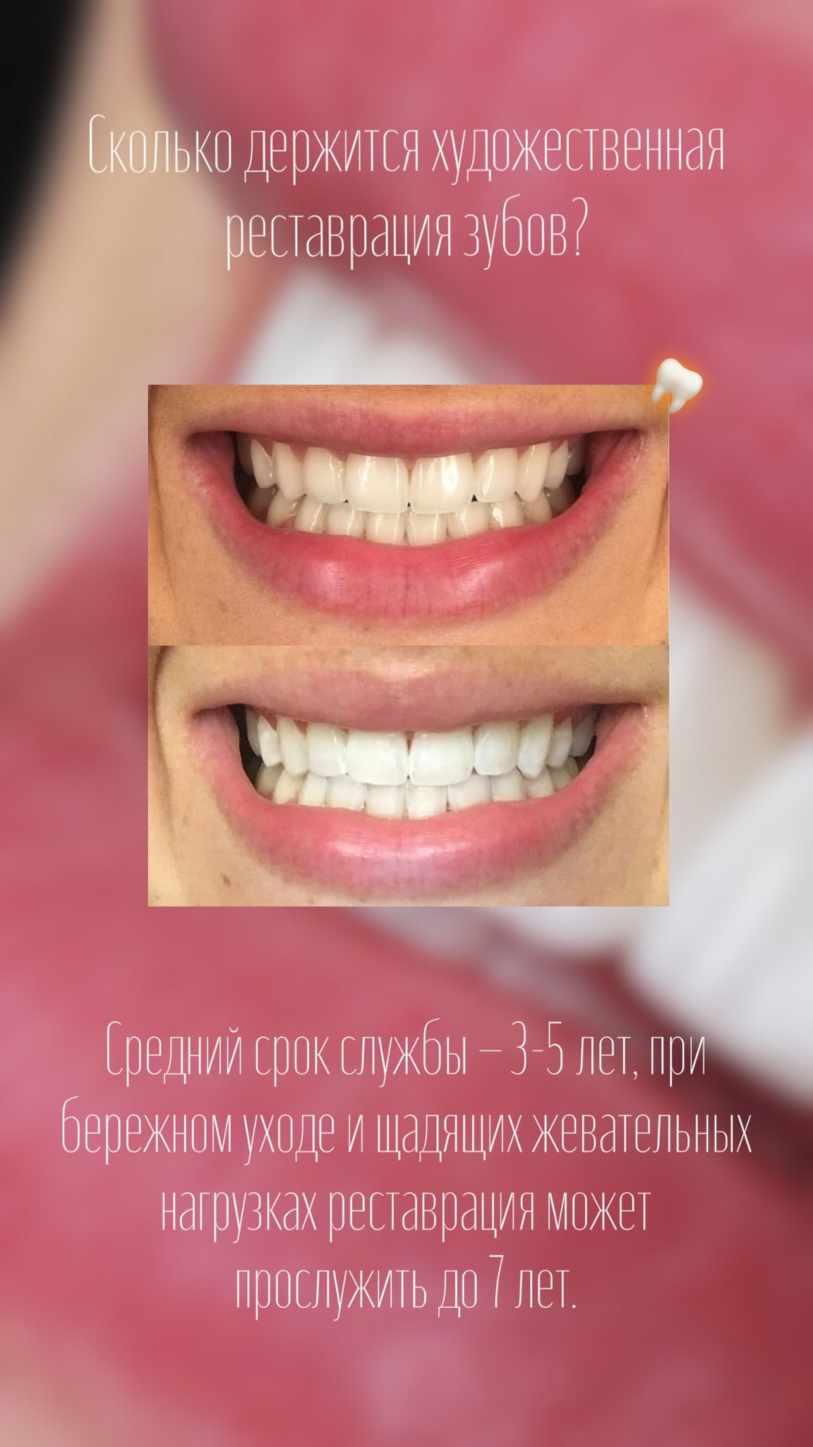 Имплантация